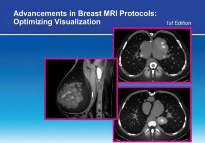 Advancements in Breast MRI Protocols: Optimizing Visualization - CME